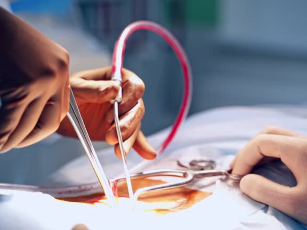 Novena Vascular Surgery: Comprehensive Care Options