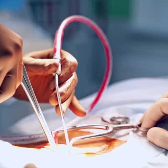 Novena Vascular Surgery: Comprehensive Care Options