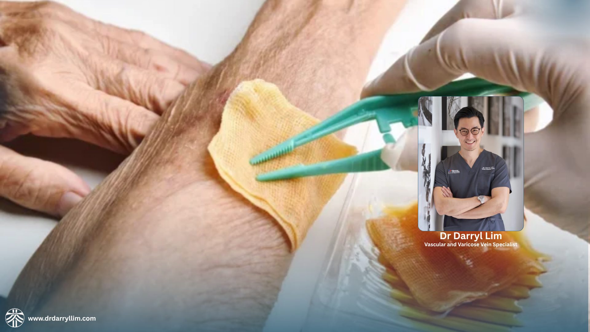 Poorly healing wound care and treatment in Singapore